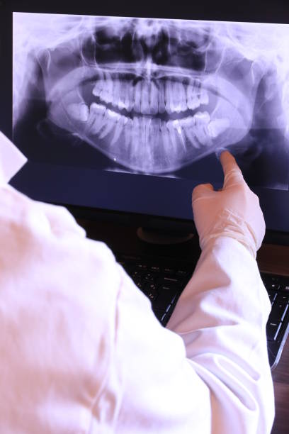 Best Emergency Wisdom Teeth Removal in Hinesville, GA